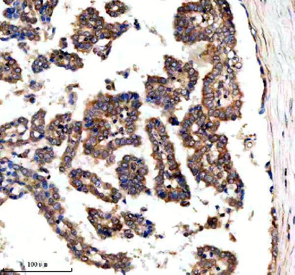  IHC analysis of SRBD1 using anti-SRBD1 antibody (A12736-1)