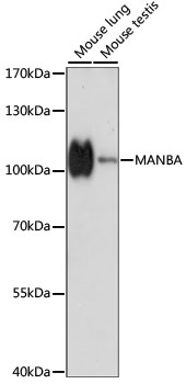 Western blot analysis of extracts of various cell lines, using MANBA antibody  at 1:1000 dilution