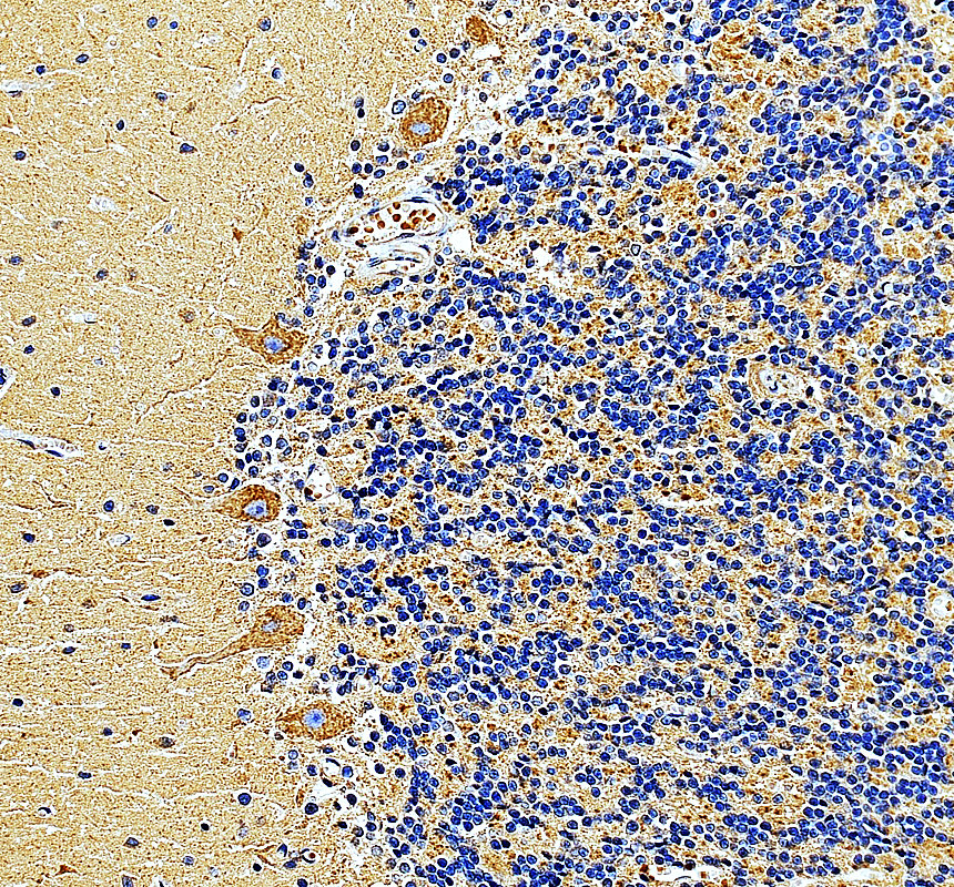 a12749 1 mrps7 primary antibodies ihc testing 1