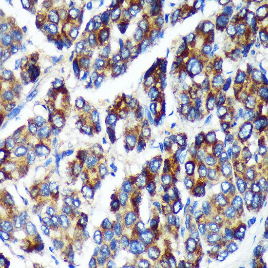 a12755 plekhb2 primary antiboties ihc testing 2