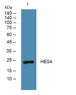 Western blot analysis of lysates from K562 cells, primary antibody was diluted at 1:1000, 4°over night