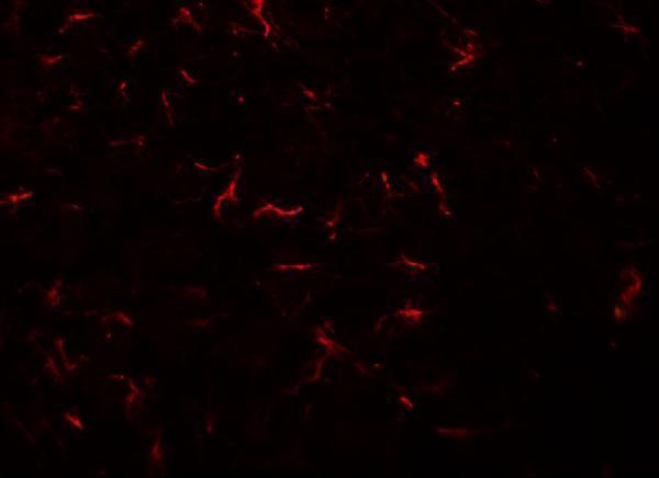 Immunofluorescence of VENTX in rat brain tissue with VENTX antibody at 20 μg/mL