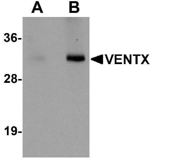 Western blot analysis of VENTX in mouse brain tissue lysate with VENTX antibody at (A) 1 and (B) 2 μg/mL