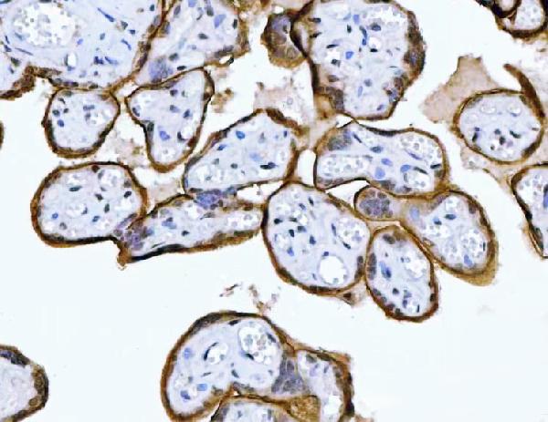 Figure 2. IHC analysis of MRPS18B using anti-MRPS18B antibody (A12773-1). MRPS18B was detected in a paraffin-embedded section of human placenta tissue. Heat mediated antigen retrieval was performed in EDTA buffer (pH 8.0, epitope retrieval solution). The tissue section was blocked with 10% goat serum. The tissue section was then incubated with 2 microg/ml rabbit anti-MRPS18B Antibody (A12773-1) overnight at 4°C. Peroxidase Conjugated Goat Anti-rabbit IgG was used as secondary antibody and incubated for 30 minutes at 37°C. The tissue section was developed using HRP Conjugated Rabbit IgG Super Vision Assay Kit (Catalog # SV0002) with DAB as the chromogen.