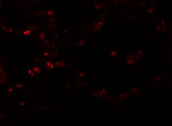 Immunofluorescence of TMEM184B in human lung tissue with TMEM184B antibody at 20 μg/mL