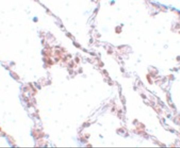 Immunohistochemistry of TMEM184B in human lung tissue with TMEM184B antibody at 5 μg/mL