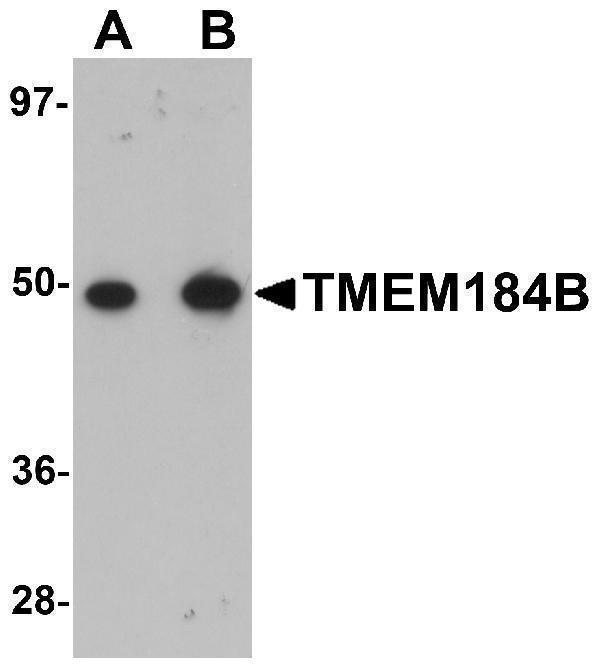 Western blot analysis of TMEM184B in rat lung tissue lysate with TMEM184B antibody at (A) 1 and (B) 2 μg/mL
