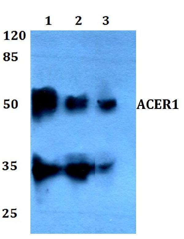 Western blot (WB) analysis of ACER1 polyclonal antibody at 1:500 dilution
Lane1:HepG2 whole cell lysate
Lane2:Raw264