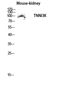Western blot analysis of Mouse-kidney lysis using TNNI3K antibody