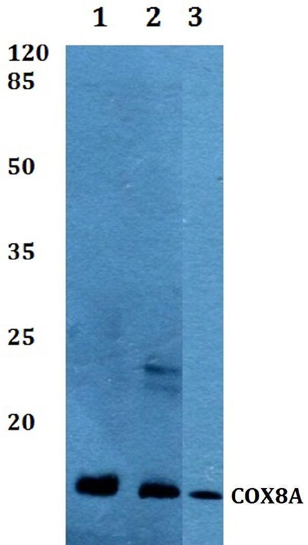 Western blot (WB) analysis of COX8A polyclonal antibody at 1:500 dilution
Lane1:A549 whole cell lysate
Lane2:sp2/0 whole cell lysate
Lane3:Rat brain tissue lysate