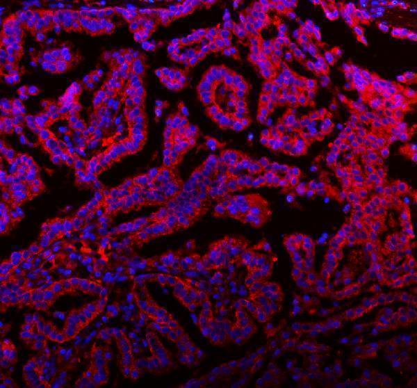 a12786 malsu1 primary antibodies if testing 15