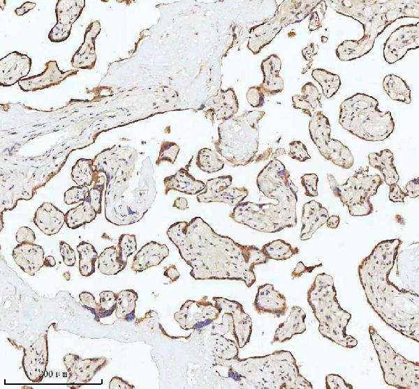 Figure 8. IHC analysis of C7orf30/MALSU1 using anti-C7orf30/MALSU1 antibody (A12786). C7orf30/MALSU1 was detected in a paraffin-embedded section of human placenta tissue. Heat mediated antigen retrieval was performed in EDTA buffer (pH 8.0, epitope retrieval solution). The tissue section was blocked with 10% goat serum. The tissue section was then incubated with 2 microg/ml rabbit anti-C7orf30/MALSU1 Antibody (A12786) overnight at 4°C. Peroxidase Conjugated Goat Anti-rabbit IgG was used as secondary antibody and incubated for 30 minutes at 37°C. The tissue section was developed using HRP Conjugated Rabbit IgG Super Vision Assay Kit (Catalog # SV0002) with DAB as the chromogen. Figure 8. IHC analysis of C7orf30/MALSU1 using anti-C7orf30/MALSU1 antibody (A12786). C7orf30/MALSU1 was detected in a paraffin-embedded section of human placenta tissue. Heat mediated antigen retrieval was performed in EDTA buffer (pH 8.0, epitope retrieval solution). The tissue section was blocked with 10% goat serum. The tissue section was then incubated with 2 microg/ml rabbit anti-C7orf30/MALSU1 Antibody (A12786) overnight at 4°C. Peroxidase Conjugated Goat Anti-rabbit IgG was used as secondary antibody and incubated for 30 minutes at 37°C. The tissue section was developed using HRP Conjugated Rabbit IgG Super Vision Assay Kit (Catalog # SV0002) with DAB as the chromogen.