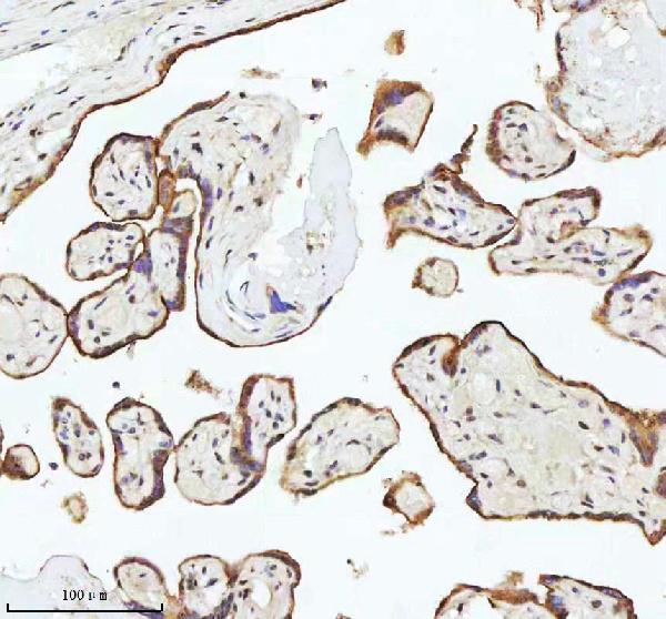 Figure 9. IHC analysis of C7orf30/MALSU1 using anti-C7orf30/MALSU1 antibody (A12786). C7orf30/MALSU1 was detected in a paraffin-embedded section of human placenta tissue. Heat mediated antigen retrieval was performed in EDTA buffer (pH 8.0, epitope retrieval solution). The tissue section was blocked with 10% goat serum. The tissue section was then incubated with 2 microg/ml rabbit anti-C7orf30/MALSU1 Antibody (A12786) overnight at 4°C. Peroxidase Conjugated Goat Anti-rabbit IgG was used as secondary antibody and incubated for 30 minutes at 37°C. The tissue section was developed using HRP Conjugated Rabbit IgG Super Vision Assay Kit (Catalog # SV0002) with DAB as the chromogen. Figure 9. IHC analysis of C7orf30/MALSU1 using anti-C7orf30/MALSU1 antibody (A12786). C7orf30/MALSU1 was detected in a paraffin-embedded section of human placenta tissue. Heat mediated antigen retrieval was performed in EDTA buffer (pH 8.0, epitope retrieval solution). The tissue section was blocked with 10% goat serum. The tissue section was then incubated with 2 microg/ml rabbit anti-C7orf30/MALSU1 Antibody (A12786) overnight at 4°C. Peroxidase Conjugated Goat Anti-rabbit IgG was used as secondary antibody and incubated for 30 minutes at 37°C. The tissue section was developed using HRP Conjugated Rabbit IgG Super Vision Assay Kit (Catalog # SV0002) with DAB as the chromogen.