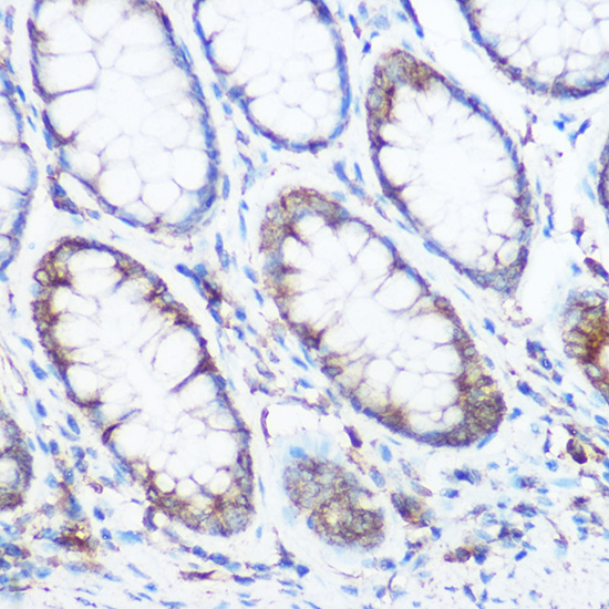 a12789 nomo1 primary antiboties ihc testing 2