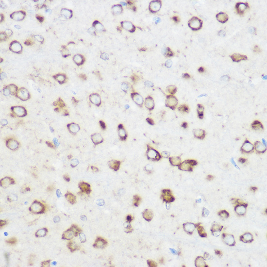 a12789 nomo1 primary antiboties ihc testing 3