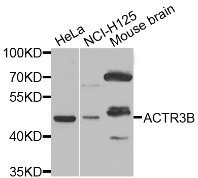 a12792 actr3b primary antiboties wb testing 1