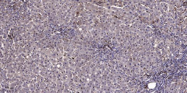 Immunohistochemical analysis of paraffin-embedded human liver cancer