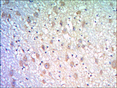 a12797 klhl21 primary antibodyes ihc testing 2