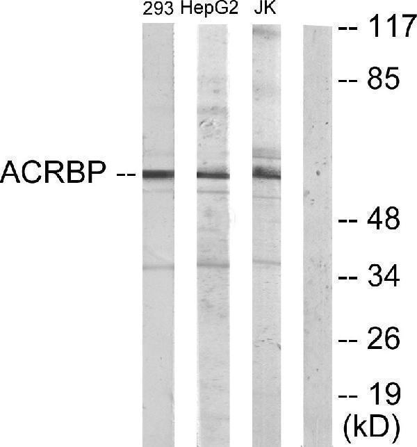 Western blot analysis of lysates from HepG2, Jurkat, and 293 cells, using ACRBP Antibody