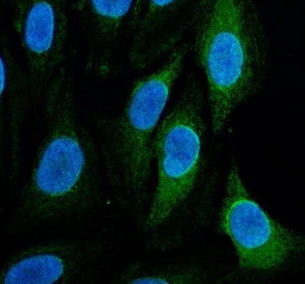 IF analysis of FBXL14 using anti-FBXL14 antibody (A12808-1)