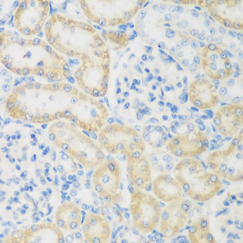 Immunohistochemistry of paraffin-embedded rat kidney using NAT8B antibody  at dilution of 1:200 