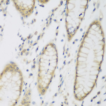 Immunohistochemistry of paraffin-embedded human stomach using NAT8B antibody  at dilution of 1:200 