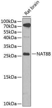 Western blot analysis of extracts of rat brain, using NAT8B antibody  at 1:1000 dilution