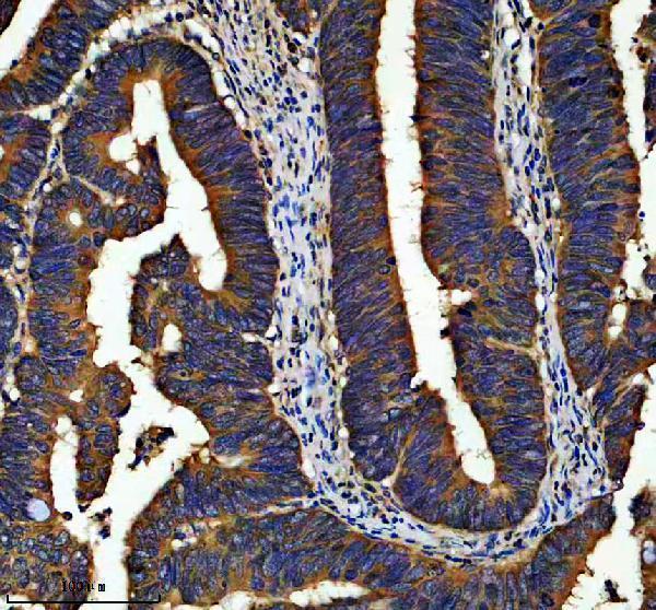 IHC analysis of GALNT8 using anti-GALNT8 antibody (A12824)