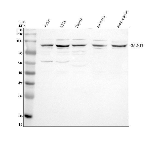 Western blot analysis of GALNT8 using anti-GALNT8 antibody (A12824)