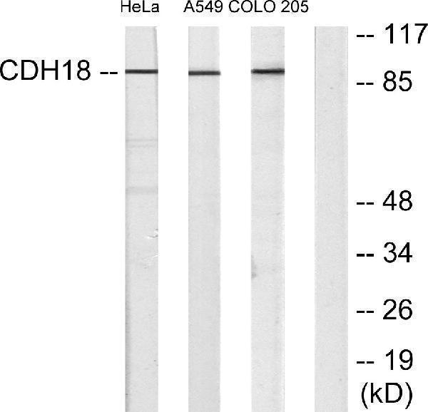 a12825 cdh18 primary antibodies wb testing 1