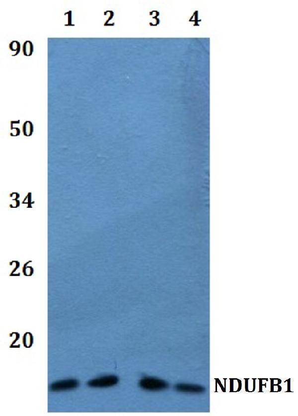 Western blot (WB) analysis of NDUFB1 polyclonal antibody at 1:500 dilution  Lane1:HEK293T whole cell lysate
Lane2:RAW264