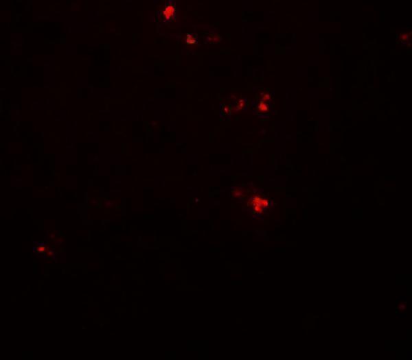 a12829 dtx4 primary antibodies if testing 3