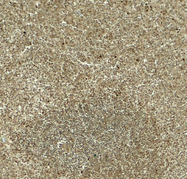 a12829 dtx4 primary antibodies ihc testing 2