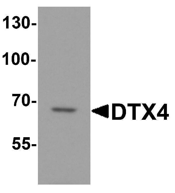a12829 dtx4 primary antibodies wb testing 1