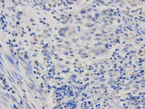 a12839 polr2d primary antiboties if testing 2