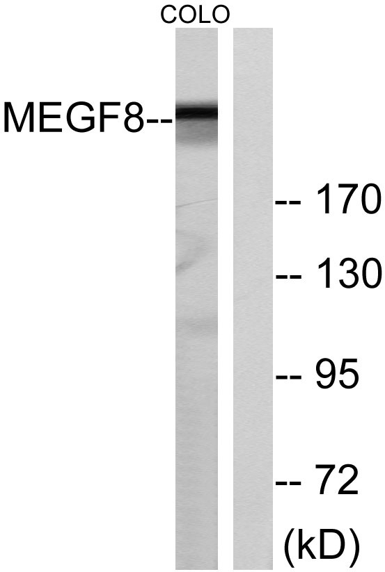 Western blot analysis of lysates from COLO cells, using MEGF8 Antibody
