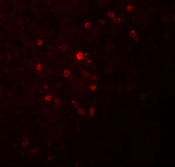 Immunofluorescence of TSPAN9 in human spleen tissue with TSPAN9 antibody at 20 μg/mL