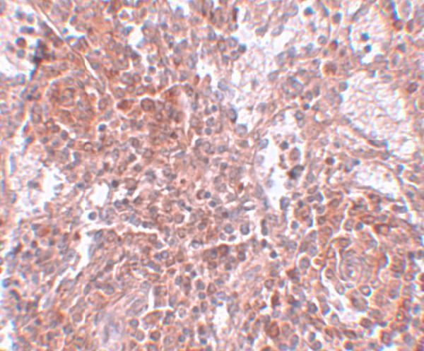 Immunohistochemistry of TSPAN9 in human spleen tissue with TSPAN9 antibody at 2