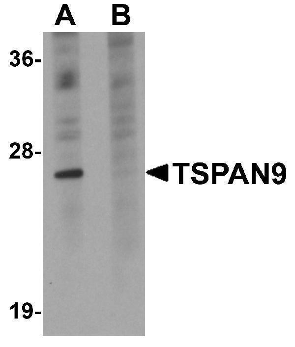 Western blot analysis of TSPAN9 in EL4 cell lysate with TSPAN9 antibody at 1 μg/mL in (A) the absence and (B) the presence of blocking peptide