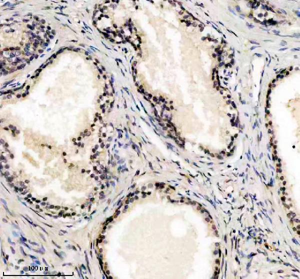 a12847 1 ube2f primary antibodies ihc testing 1