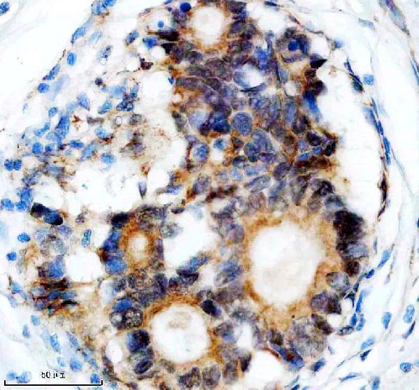 a12850 3 ddx55 primary antibodies ihc testing 1