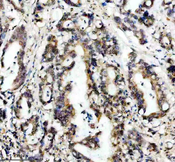 a12850 3 ddx55 primary antibodies ihc testing 2