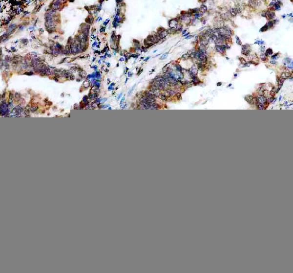 a12850 3 ddx55 primary antibodies ihc testing 3
