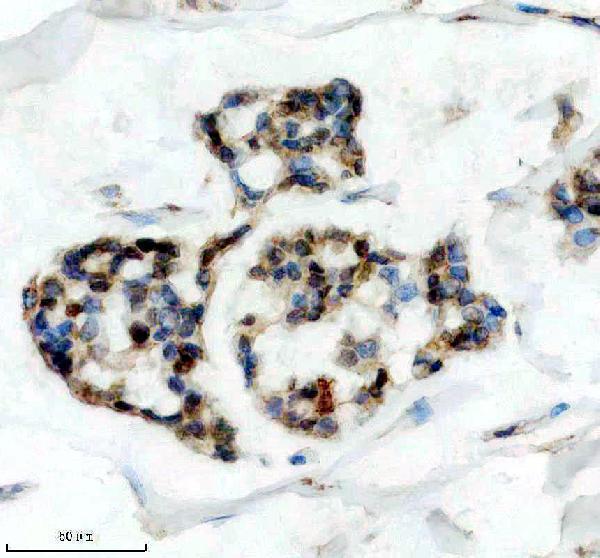 a12850 3 ddx55 primary antibodies ihc testing 4