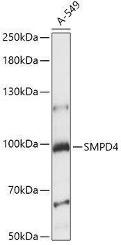 Western blot analysis of extracts of A-549 cells, using SMPD4 antibody  at 1:1000 dilution