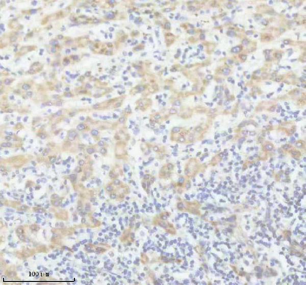 IHC analysis of PTGDR2 using anti-PTGDR2 antibody (A12856-2)