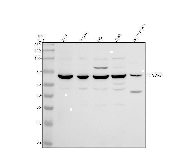 Western blot analysis of PTGDR2 using anti-PTGDR2 antibody (A12856-2)