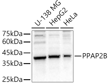 Western blot analysis of various lysates, using PPAP2B antibody  at  1:1100 dilution