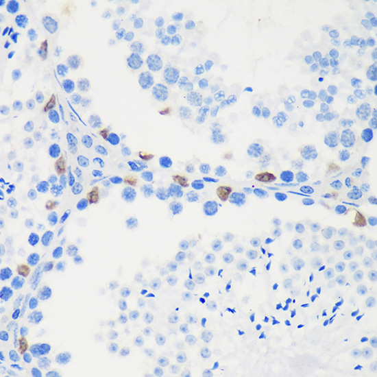 Immunohistochemistry of paraffin-embedded Mouse testis using LARP1B Rabbit pAb  at dilution of 1:100 