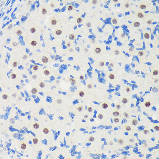 Immunohistochemistry of paraffin-embedded Rat ovary using LARP1B Rabbit pAb  at dilution of 1:100 